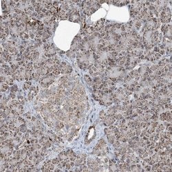 Invitrogen SUCLG1 Polyclonal Antibody 100 &mu;L; Unconjugated:Antibodies,