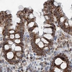 Invitrogen SUCLG1 Polyclonal Antibody 100 &mu;L; Unconjugated:Antibodies,