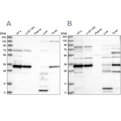 Invitrogen SUCLG1 Polyclonal Antibody 100 &mu;L; Unconjugated:Antibodies,