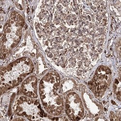 Invitrogen&trade;&nbsp;FANCL Polyclonal Antibody
