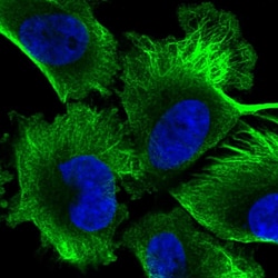 EML4 Polyclonal Antibody:Antibodies, Polyclonal
