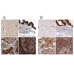 EML4 Polyclonal Antibody:Antibodies, Polyclonal