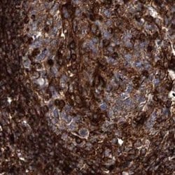EML4 Polyclonal Antibody:Antibodies, Polyclonal