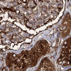 EML4 Polyclonal Antibody:Antibodies, Polyclonal