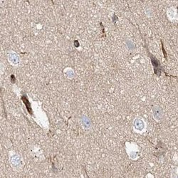 EML4 Polyclonal Antibody:Antibodies, Polyclonal