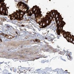 EML4 Polyclonal Antibody:Antibodies, Polyclonal