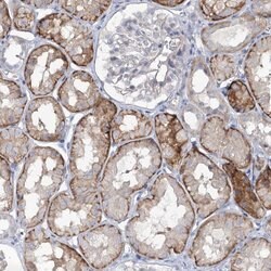 Invitrogen LZK Polyclonal Antibody 100 &mu;L | Buy Online | Invitrogen&trade; | Fisher Scientific