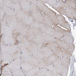 Invitrogen LZK Polyclonal Antibody 100 &mu;L; Unconjugated:Antibodies,