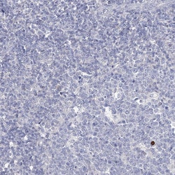 Invitrogen LZK Polyclonal Antibody 100 &mu;L; Unconjugated:Antibodies,