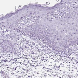 Invitrogen TFF2 Polyclonal Antibody 100 &mu;L; Unconjugated:Antibodies,