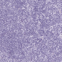 Invitrogen TFF2 Polyclonal Antibody 100 &mu;L; Unconjugated:Antibodies,