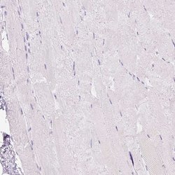 Invitrogen TFF2 Polyclonal Antibody 100 &mu;L; Unconjugated:Antibodies,