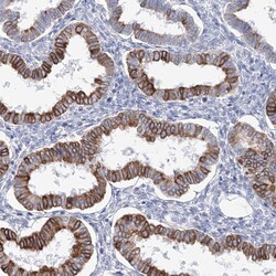 Invitrogen LRRIQ4 Polyclonal Antibody 100 &mu;L; Unconjugated:Antibodies,