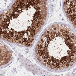 Invitrogen Adenylate Kinase 9 Polyclonal Antibody 100 &mu;L; Unconjugated:Antibodies,