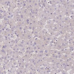 Invitrogen Adenylate Kinase 9 Polyclonal Antibody 100 &mu;L; Unconjugated:Antibodies,
