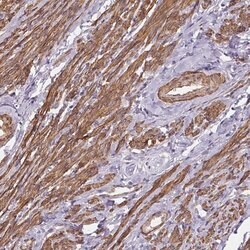 Invitrogen GPX8 Polyclonal Antibody 100 &mu;L; Unconjugated:Antibodies,