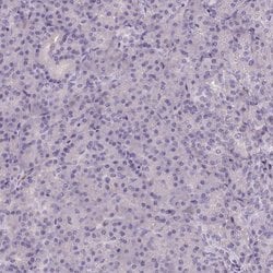 Invitrogen GPX8 Polyclonal Antibody 100 &mu;L; Unconjugated:Antibodies,
