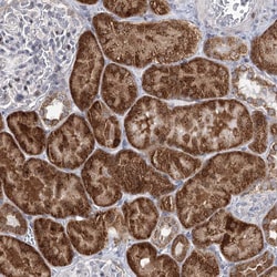 PTGR1 Polyclonal Antibody:Antibodies, Polyclonal