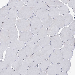 PTGR1 Polyclonal Antibody:Antibodies, Polyclonal