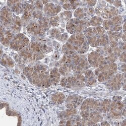 PTGR1 Polyclonal Antibody:Antibodies, Polyclonal