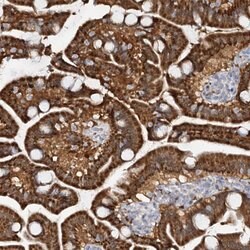 PTGR1 Polyclonal Antibody:Antibodies, Polyclonal