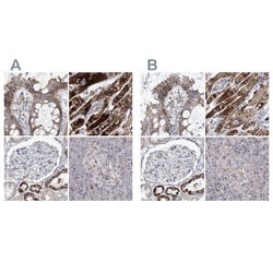 PDHB Polyclonal Antibody:Antibodies, Polyclonal