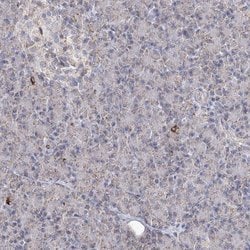 PDHB Polyclonal Antibody:Antibodies, Polyclonal
