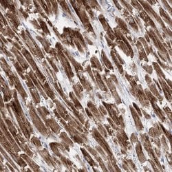 PDHB Polyclonal Antibody:Antibodies, Polyclonal