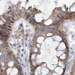 PDHB Polyclonal Antibody:Antibodies, Polyclonal