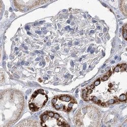 PDHB Polyclonal Antibody:Antibodies, Polyclonal