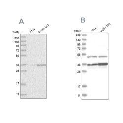 PDHB Polyclonal Antibody:Antibodies, Polyclonal