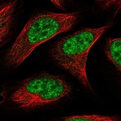 Invitrogen CWC22 Polyclonal Antibody 100 &mu;L; Unconjugated:Antibodies,