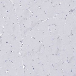 Invitrogen BPHL Polyclonal Antibody 100 &mu;L; Unconjugated:Antibodies,