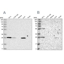Invitrogen BPHL Polyclonal Antibody 100 &mu;L; Unconjugated:Antibodies,