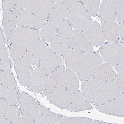 BPHL Polyclonal Antibody:Antibodies, Polyclonal