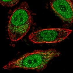BPHL Polyclonal Antibody:Antibodies, Polyclonal