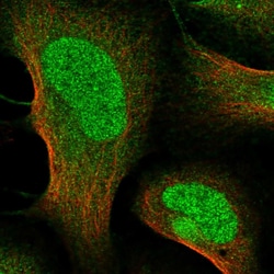 Invitrogen™ ANKS1 Polyclonal Antibody