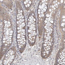Invitrogen&trade;&nbsp;ANKS1 Polyclonal Antibody