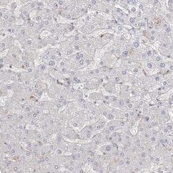 Invitrogen&trade;&nbsp;ANKS1 Polyclonal Antibody