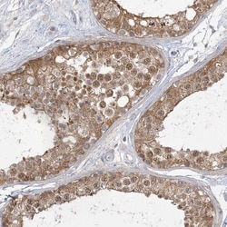 Invitrogen&trade;&nbsp;ANKS1 Polyclonal Antibody