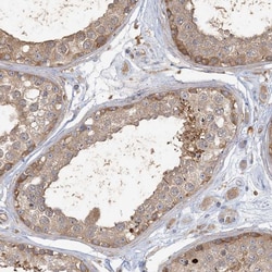 Invitrogen™ ANKS1 Polyclonal Antibody
