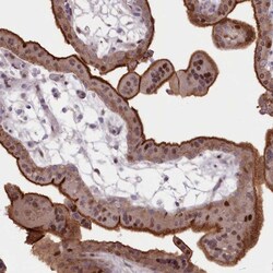 Invitrogen RNPEPL1 Polyclonal Antibody 100 &mu;L; Unconjugated:Antibodies,