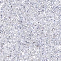 Invitrogen Nkx6.1 Polyclonal Antibody 100 &mu;L | Buy Online | Invitrogen&trade; | Fisher Scientific