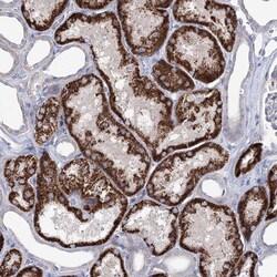 Invitrogen C5orf42 Polyclonal Antibody 100 μL; Unconjugated:Antibodies,