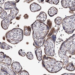 Invitrogen C5orf42 Polyclonal Antibody 100 μL; Unconjugated:Antibodies,