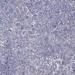 Invitrogen C5orf42 Polyclonal Antibody 100 μL; Unconjugated:Antibodies,