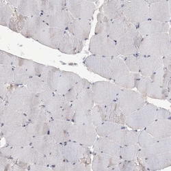 TTC7A Polyclonal Antibody 100 &mu;L | Buy Online | Thermo Scientific | Fisher Scientific