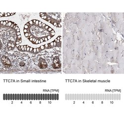 TTC7A Polyclonal Antibody 100 &mu;L | Buy Online | Thermo Scientific | Fisher Scientific