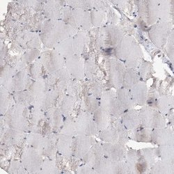 TTC7A Polyclonal Antibody 100 &mu;L | Buy Online | Thermo Scientific | Fisher Scientific