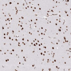 Invitrogen ZNF638 Polyclonal Antibody 100 &mu;L; Unconjugated:Antibodies,